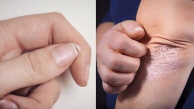 Quando o corpo pede ajuda: 10 "sinais" que indicam que não somos tão saudáveis ​​quanto pensamos