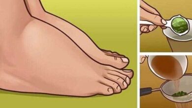 1750473667 excelente remedio caseiro para pernas inchadas Excelente remédio caseiro para pernas inchadas 2