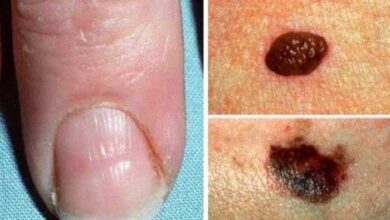 4 Sinais urgentes que o nosso corpo envia para indicar que algo não está bem!