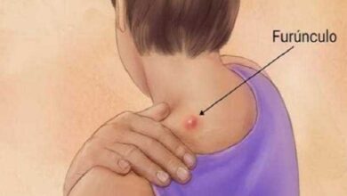 1750516987 receita para voce tratar furunculo em casa Receita para você tratar furúnculo em casa