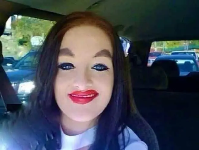 1750582267 643 32 mulheres que queriam ficar mais bonitas…mas deu muito errado 22 Mulheres que queriam ficar mais bonitas…mas deu MUITO errado