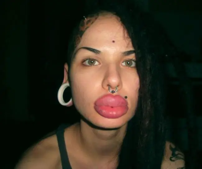 1750582268 550 32 mulheres que queriam ficar mais bonitas…mas deu muito errado 22 Mulheres que queriam ficar mais bonitas…mas deu MUITO errado
