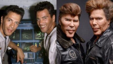 Os 20 piores resultados de cirurgias plásticas das celebridades