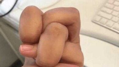 Novo desafio que está bombando nas redes sociais: Você é capaz de fazer "dedos tortos"?