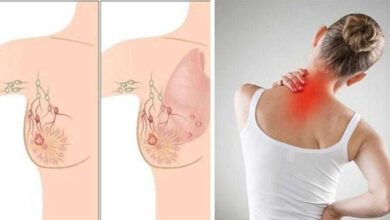 5 Sinais de câncer da mama que quase todos ignoram