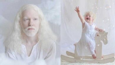 12 fotos que mostram a beleza cativante de pessoas albinas