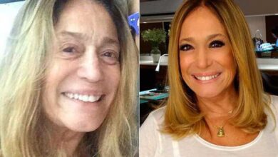 14 Famosos quase irreconhecíveis sem maquiagem