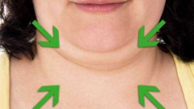 5 maneiras de eliminar a gordura da papada ou queixo duplo