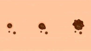 7 sinais discretos de que seu filho precisa ir ao médico