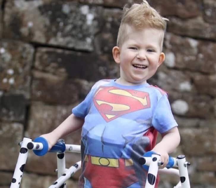 1750707615 102 bebe nasceu sem cerebro mas sobreviveu anos depois um