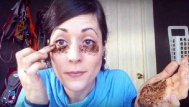 Receita para acabar com as olheiras leva apenas 2 ingredientes que você tem na cozinha