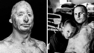 Fotos chocantes mostra como vivem os veteranos depois das guerras