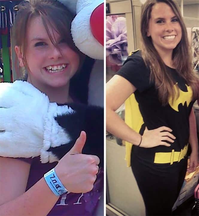 20 transformações quase inacreditáveis de pessoas que tinham dentes fora do lugar