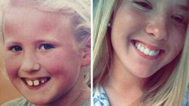 1750743756 20 transformacoes quase inacreditaveis de pessoas que tinham dentes fora 20 transformações quase inacreditáveis de pessoas que tinham dentes fora do lugar