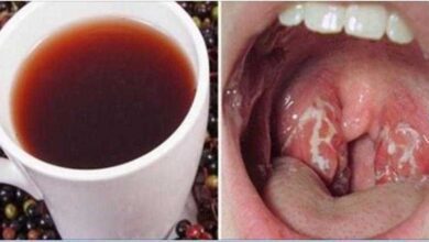 Como se livrar de uma infecção de garganta de forma natural e em pouco tempo