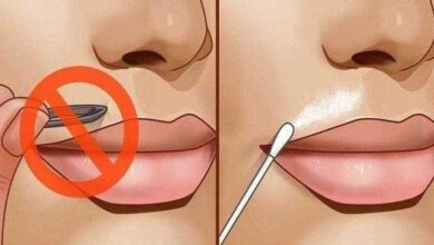 Receitas caseiras para eliminar pelos no rosto