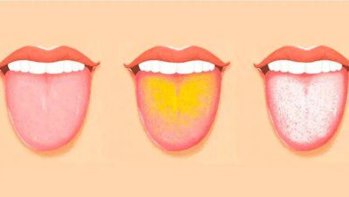 7 coisas que sua língua está tentando dizer sobre sua saúde