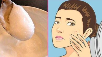 2 Maneiras para eliminar manchas na pele