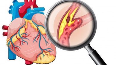 1750973058 10 coisas que voce precisa saber sobre colesterol 10 Coisas Que Você Precisa Saber Sobre Colesterol