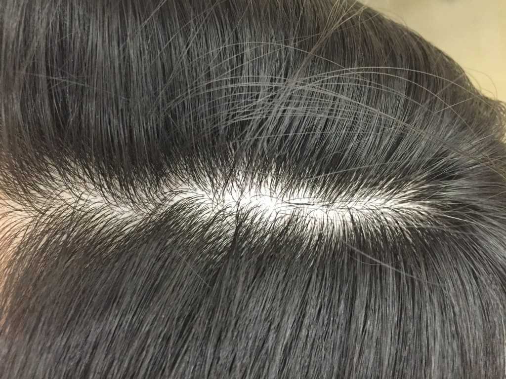 benefícios do zinco