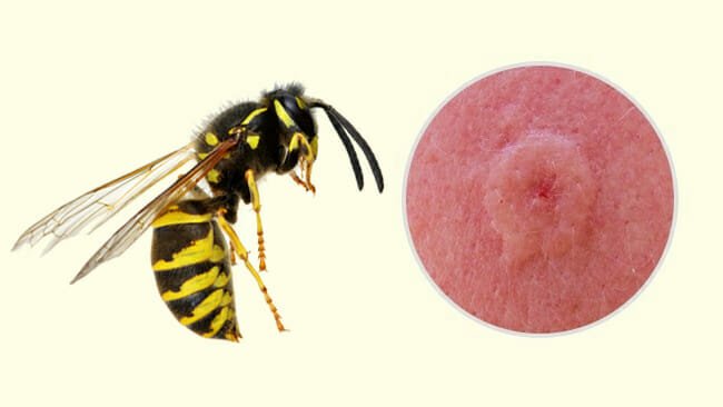 1750989311 452 10 tipos de picadas de insetos que voce deve reconhecer