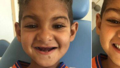 'Agora posso rir porque tenho meus dentes', afirma garoto que teve sonho realizado por dentista