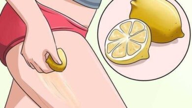 10 Dicas Para Eliminar Estrias Naturalmente