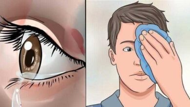 7 Remédios caseiros para coceiras nos olhos