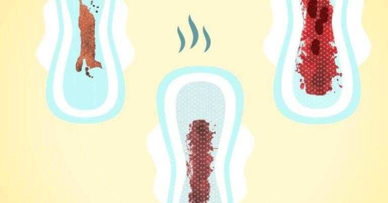 12 tipos de menstruação e o que eles dizem sobre sua saúde