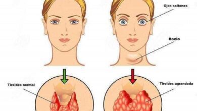 8 sinais de disfunção na tireoide e que 25 milhões de pessoas ignoram