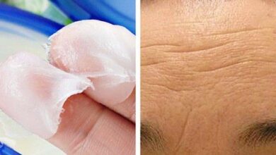 3 Cremes naturais para diminuir as rugas da testa