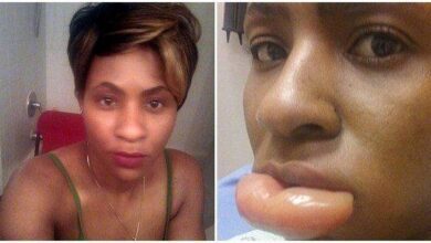Ela usou batom de uma marca famosa, o resultado foi um desastre