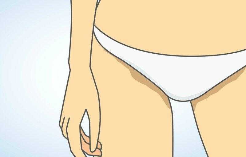 3 Dicas para eliminar manchas escuras da virilha