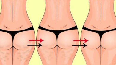 4 exercícios para acabar com a celulite