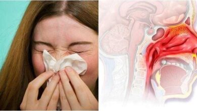 4 remédios caseiros para ajudar a curar o nariz entupido