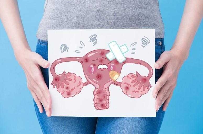 4 sinais do cancer de ovario que voce nao deve 4 sinais do câncer de ovário que você não deve ignorá-los