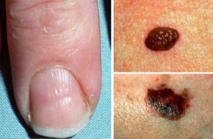 4 sinais urgentes que o nosso corpo envia para indicar 4 Sinais urgentes que o nosso corpo envia para indicar que algo não está bem!