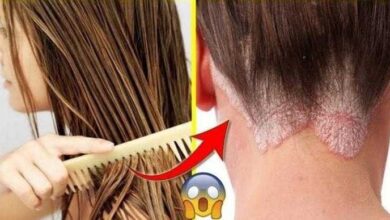 5 Razões para não dormir com cabelo molhado