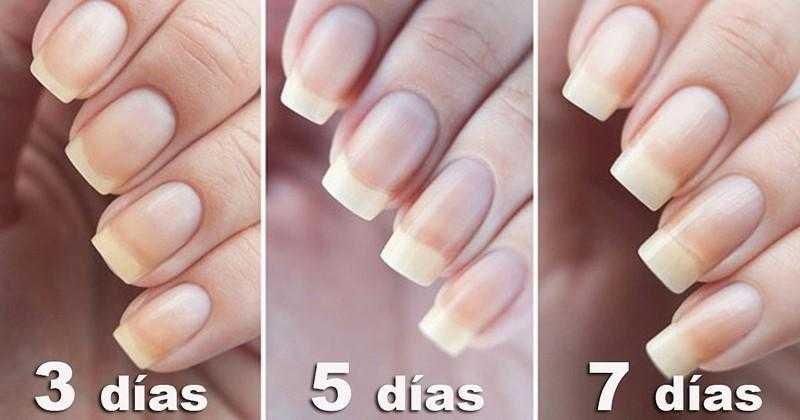 5 formas de como fazer as unhas crescerem mais rápido