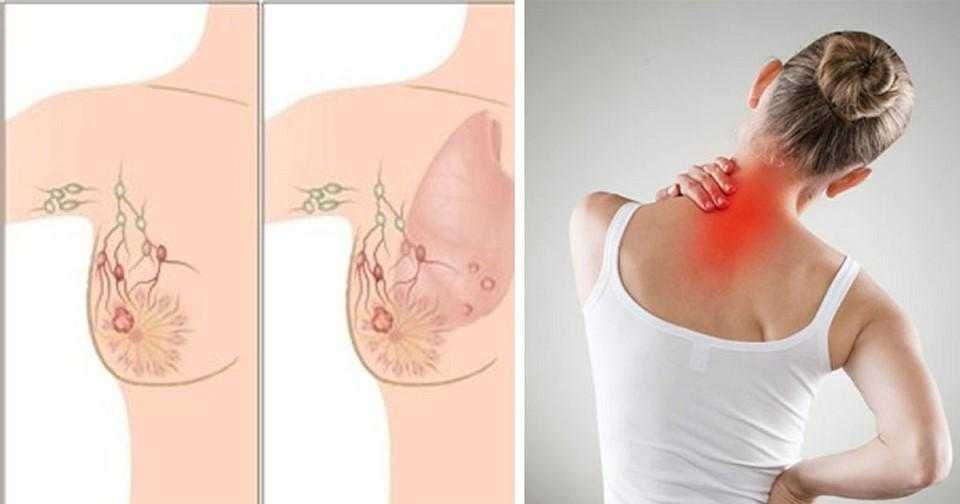5 sinais de cancer da mama que quase todos ignoram 5 Sinais de câncer da mama que quase todos ignoram
