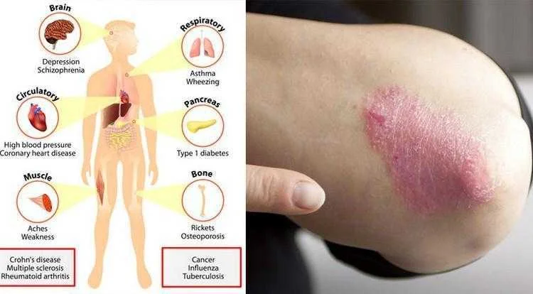 5 sinais de deficiencia de vitamina D que nao devemos.webp 5 sinais de deficiência de vitamina d que não devemos ignorar!