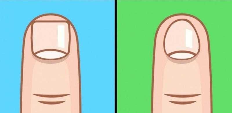 6 Coisas que a forma das unhas revela sobre voce 6 Coisas que a forma das unhas revela sobre você 4g