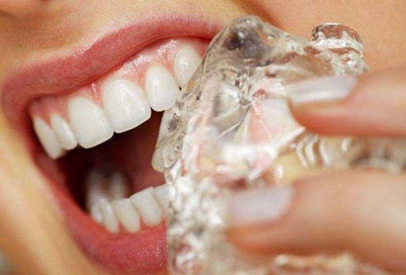 7 habitos que danificam seus dentes e voce nao sabia