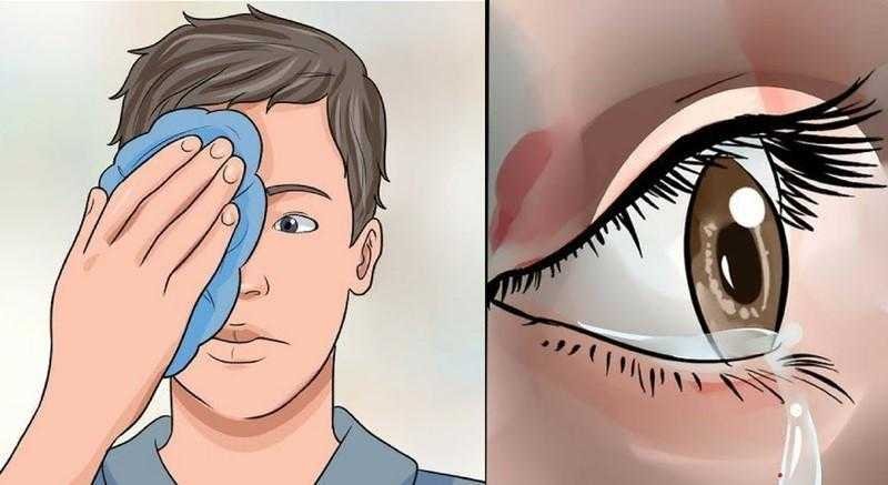 Remédios caseiros para coceiras nos olhos d