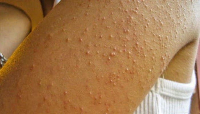 8 doenças que afetam mais as mulheres do que os homens [saúde]