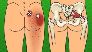 8 Sintomas de carência de cálcio e o que comer para resolver
