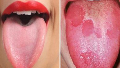 8 Sinais que sua língua dá e que podem dizer bastante sobre a sua saúde