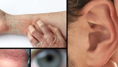 8 sintomas de pré-diabetes que você não deve ignorar