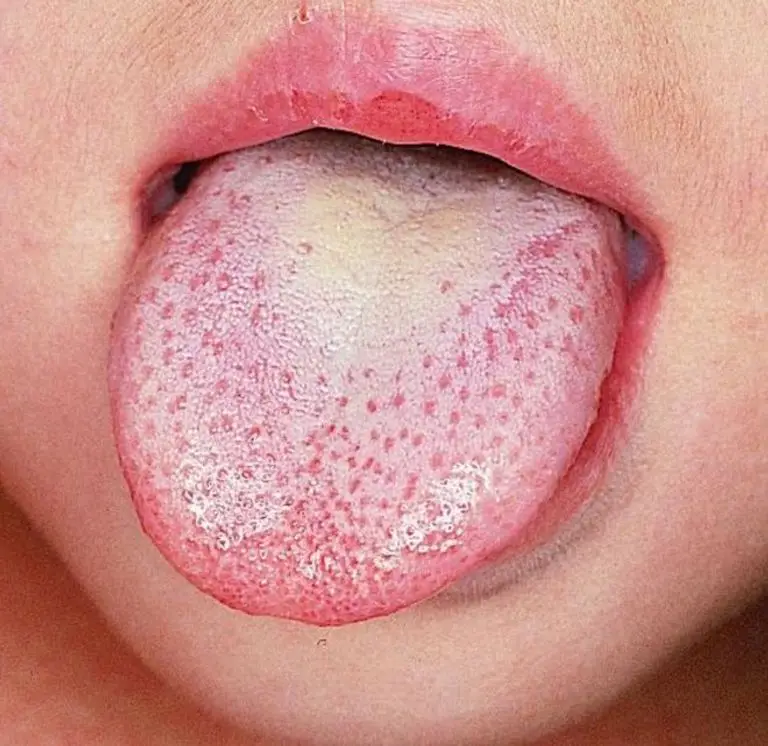 9 sinais de que seu corpo esta com excesso de 9 Sinais de que seu corpo está com excesso de toxinas