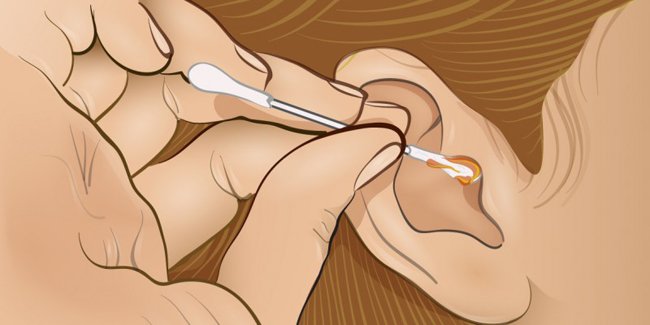 A cor da cera dos ouvidos dizem bastante sobre a sua saúde A cor da cera dos ouvidos dizem bastante sobre a sua saúde